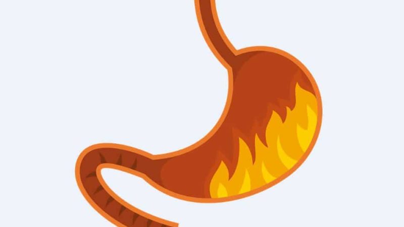 4 causes d’estomac qui brûle avec envie de vomir