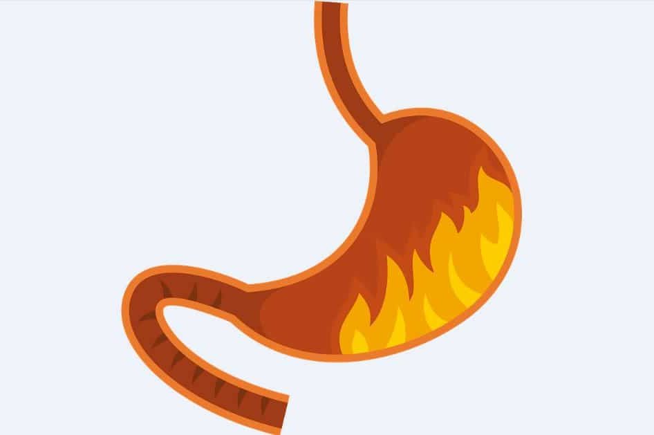 4 causes d’estomac qui brûle avec envie de vomir